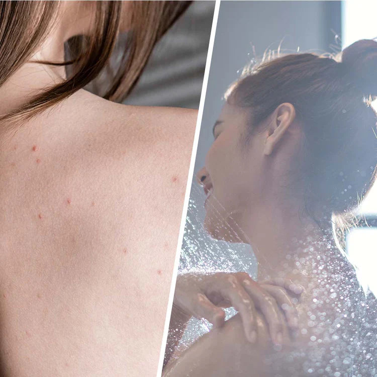 Scrub salicilic cu arbore de ceai pentru detoxifierea pielii 250 ml