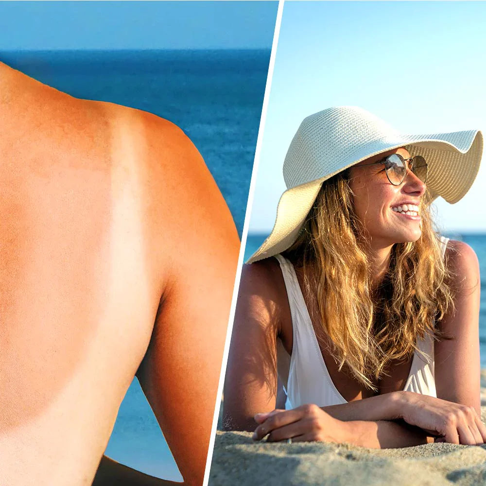 Spray de loțiune calmant cu acid hialuronic după soare - 200 ml